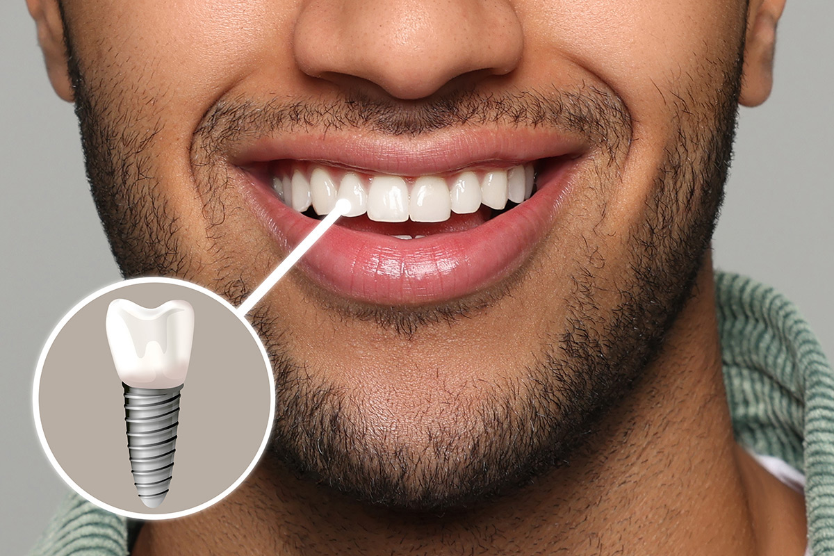 WPB Dental & Implants | Home